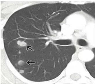 1650864386211816.jpg 1650864386211816.jpg