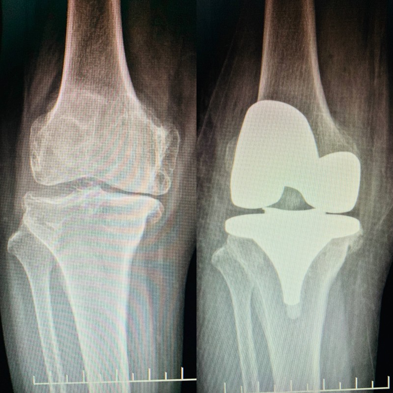 1678409850193639.jpg 20230309543a189eb309ef8c7b5e689a9b597d2c.jpg