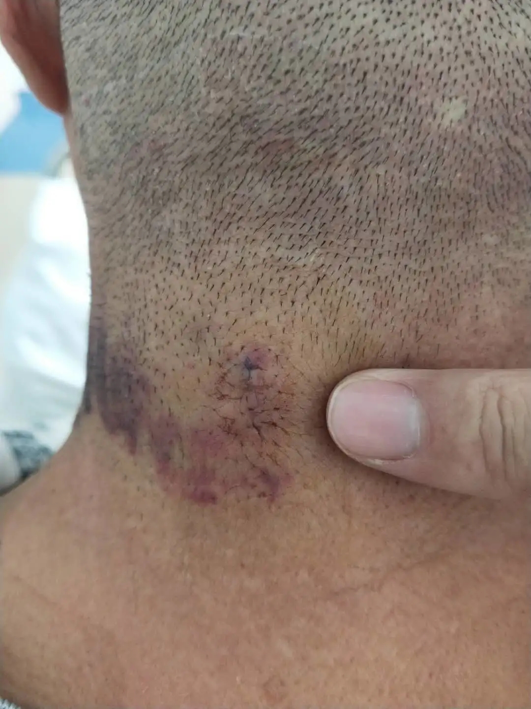 1599871159959047.jpg 1599871159959047.jpg