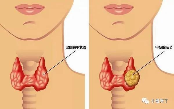 1603764694360009.jpg 微信圖片_20201027091746.jpg